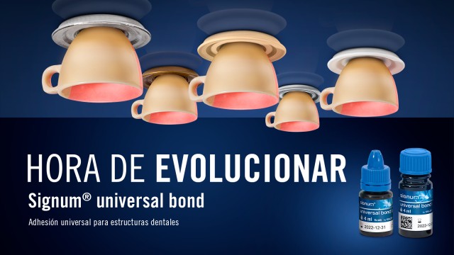 Signum universal bond