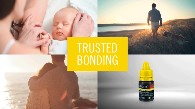 iBOND Universal